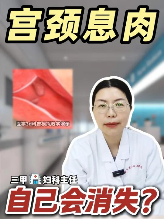 宫颈息肉，真的会自己消失吗？