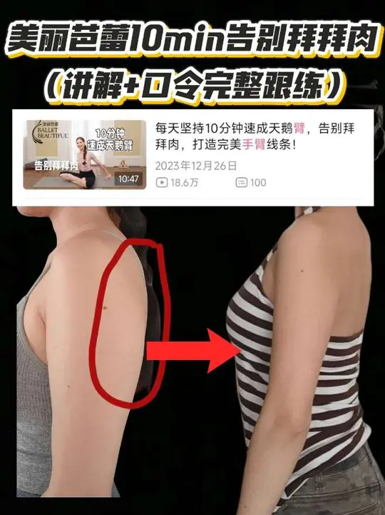 穿吊带必看，告别松垮拜拜肉，最牛的还是美丽芭蕾这姐的视频，全程数数口令跟练加讲解