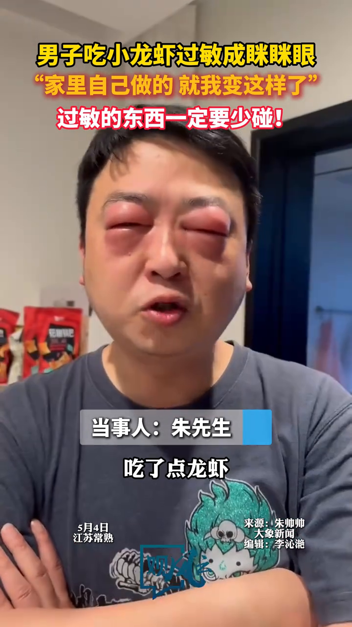 男子吃自制小龙虾过敏肿成眯眯眼 喊话网友:过敏的一定要少碰