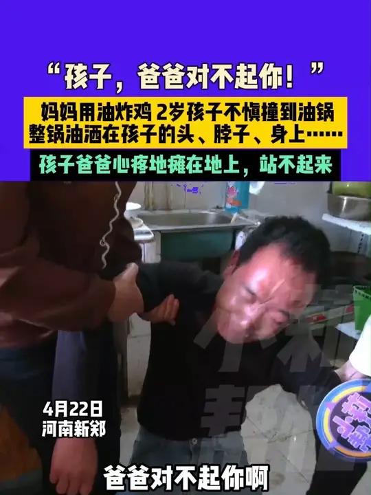 4月22日,河南新郑,“孩子,爸爸对不起你!” 妈妈用油炸鸡,2岁孩子不慎撞到油锅,整锅油