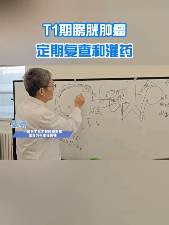 T1期膀胱肿瘤,定期复查和灌药