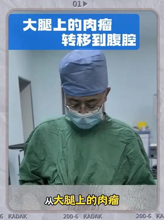 大腿上的肉瘤转移到腹腔,引起肠梗阻