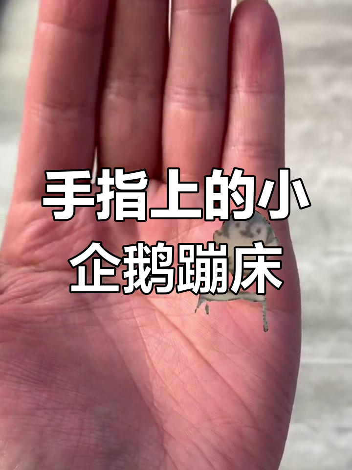 在手上画小企鹅蹦床,超有趣!教你轻松搞定