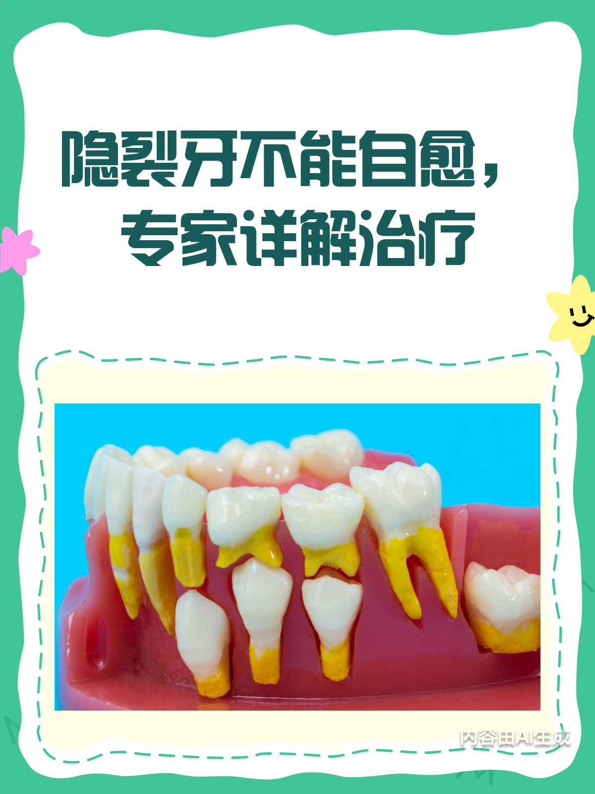 隐裂牙能自愈?别做梦了,听听专家怎么说!