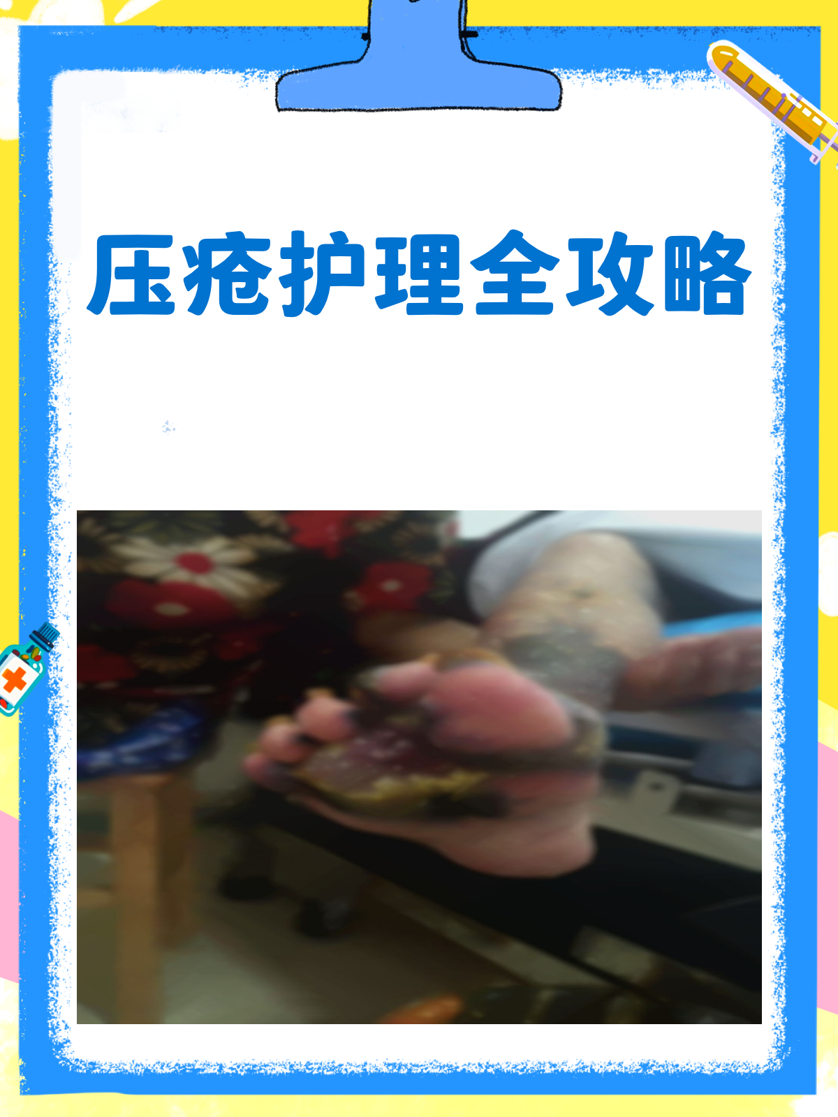 压疮护理全攻略，让患者舒适每一天！