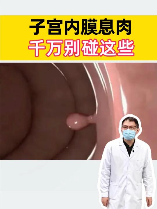 子宫内膜息肉,这些食物不要碰!