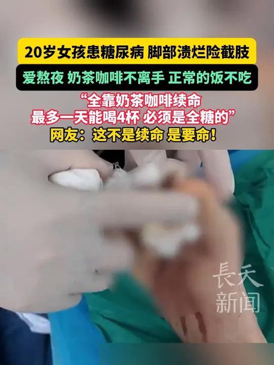 20岁女孩患糖尿病,脚部溃烂险截肢,爱熬夜,奶茶咖啡不离手,正常的饭不吃,“全靠奶茶咖啡续