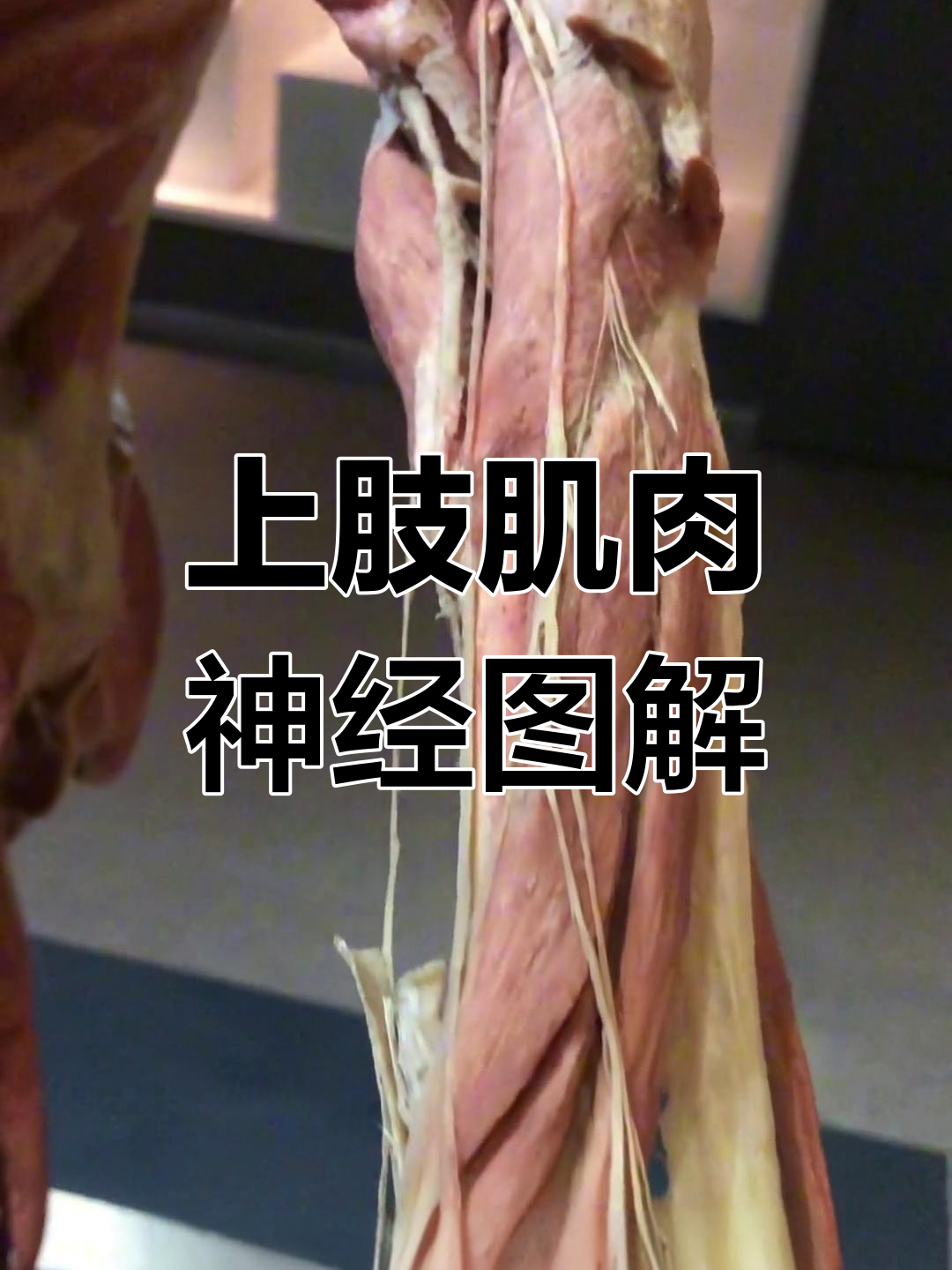 人体标本揭示手臂肌肉与神经分布