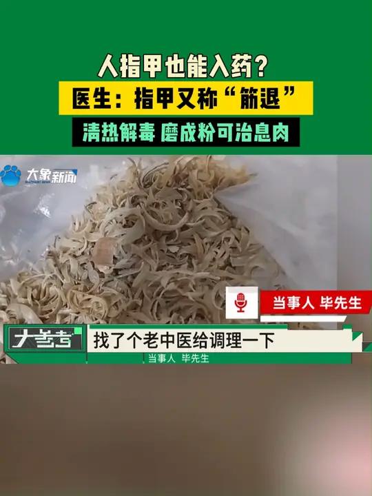 人指甲也能入药?医生:指甲又称“筋退”,清热解毒,磨成粉可治息肉