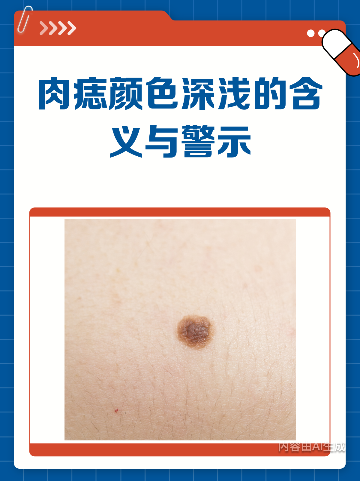 肉痣颜色变浅了?别急,听听专家怎么说