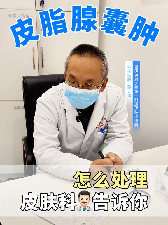 皮肤科医生告诉你皮脂腺囊肿的正确处理方式
