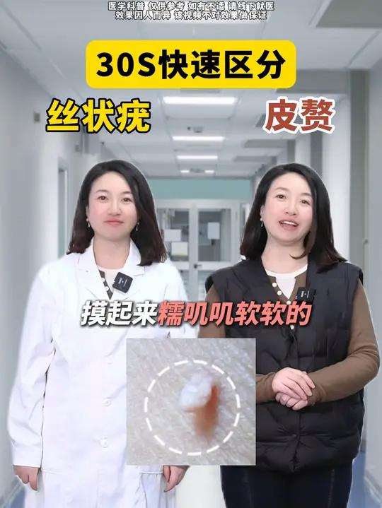 1条视频教你区分和处理丝状疣和皮赘