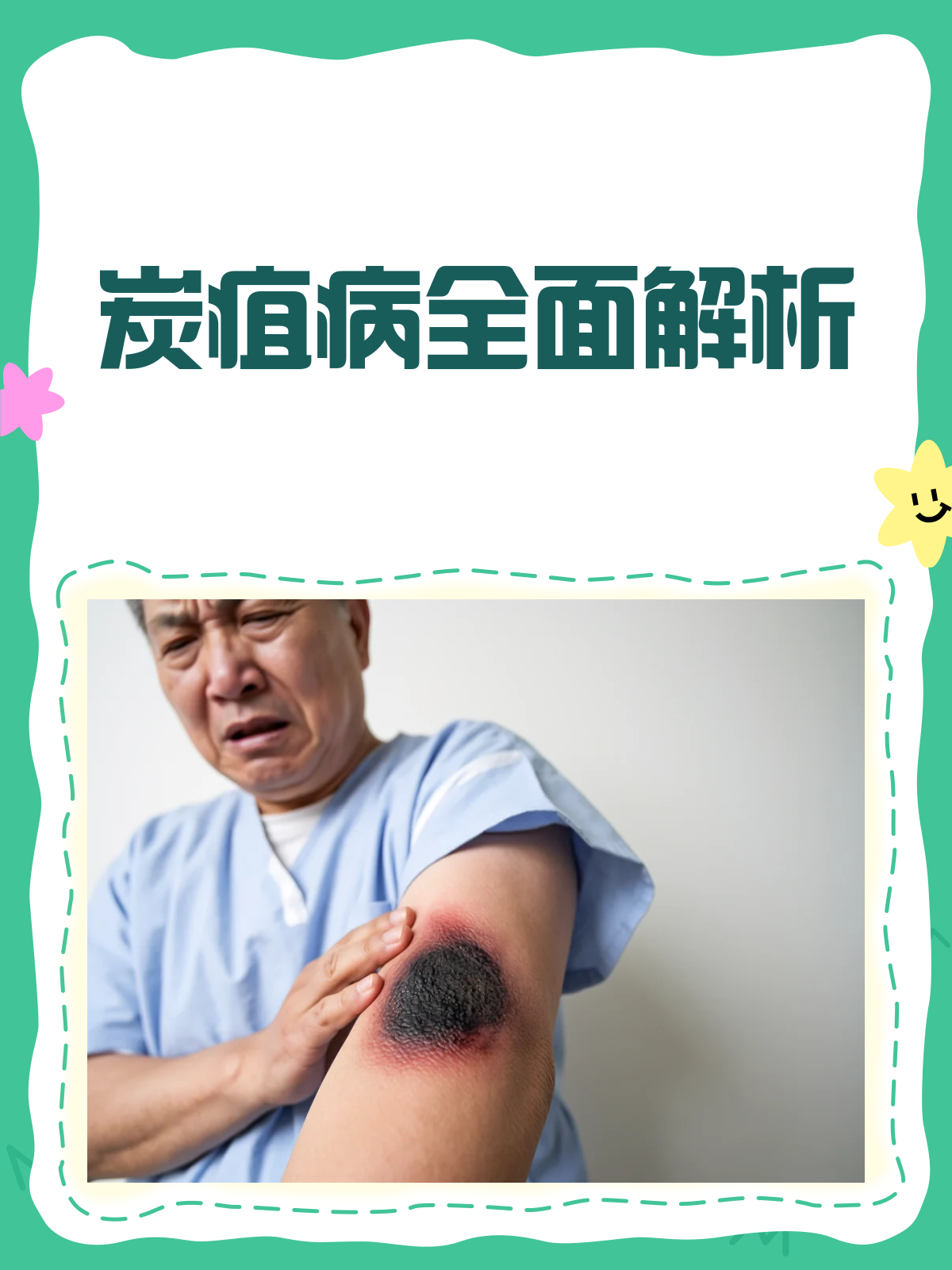 炭疽病来袭?了解它,才能战胜它!