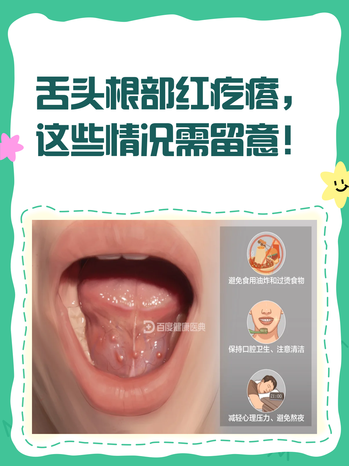 舌头根部有凸起红疙瘩?别慌,先看看这篇科普!