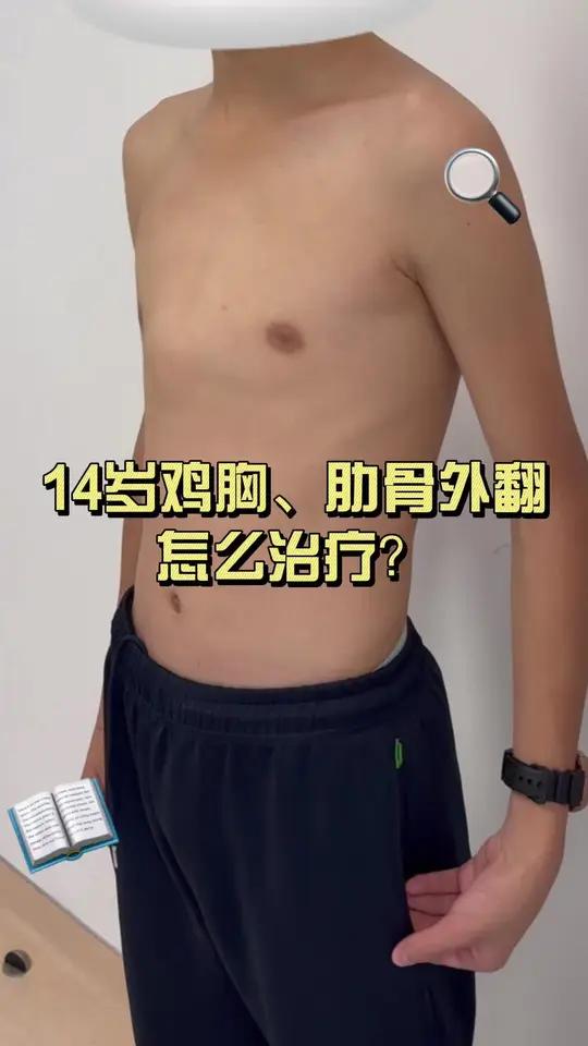 14 岁鸡胸、肋骨外翻怎么治疗