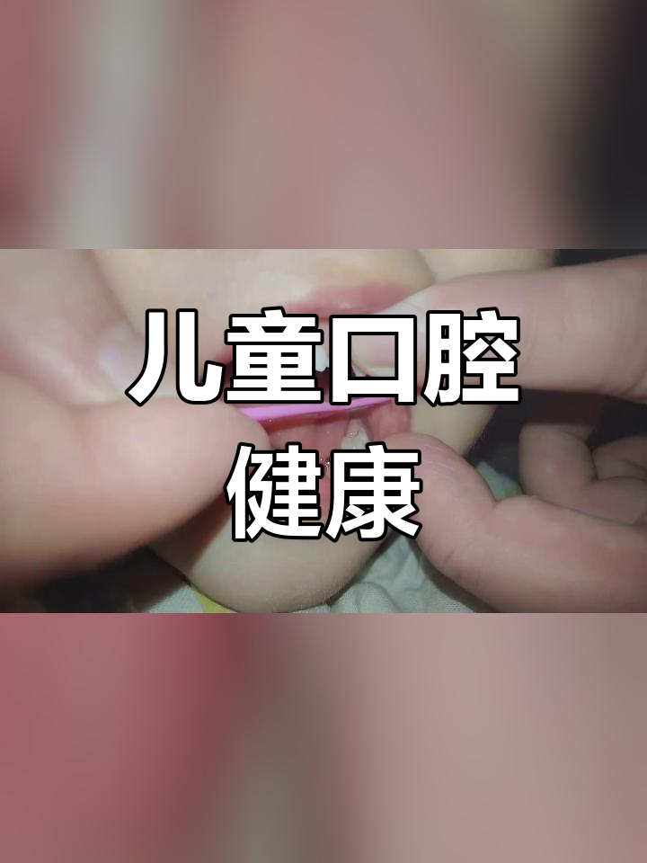 小朋友牙齿上的小肉球