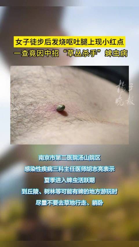 女子徒步后发烧呕吐一查竟是蜱虫病「女子徒步后腿上现小红点竟是吸血蜱虫」安徽赵女士周末去野外
