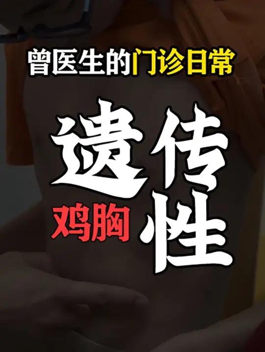 一名确诊为轻度鸡胸的小患者,可以趁着年纪小多做扩胸运动以及俯卧撑调整一下哦~遗传性鸡胸 