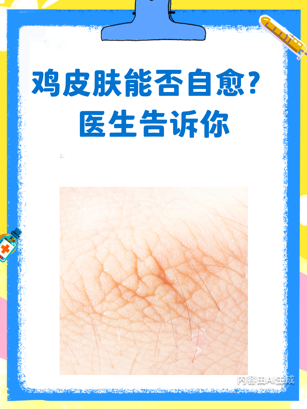 鸡皮肤能自愈吗?医生告诉你真相