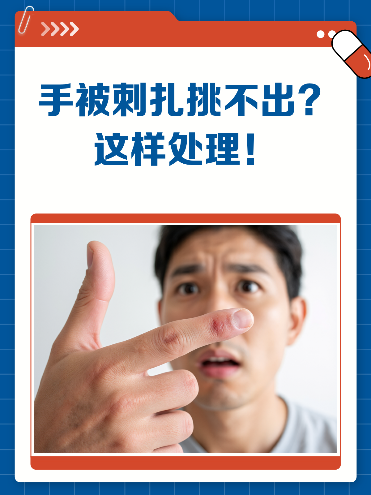 手被刺扎挑不出?别急,这样处理就对了!