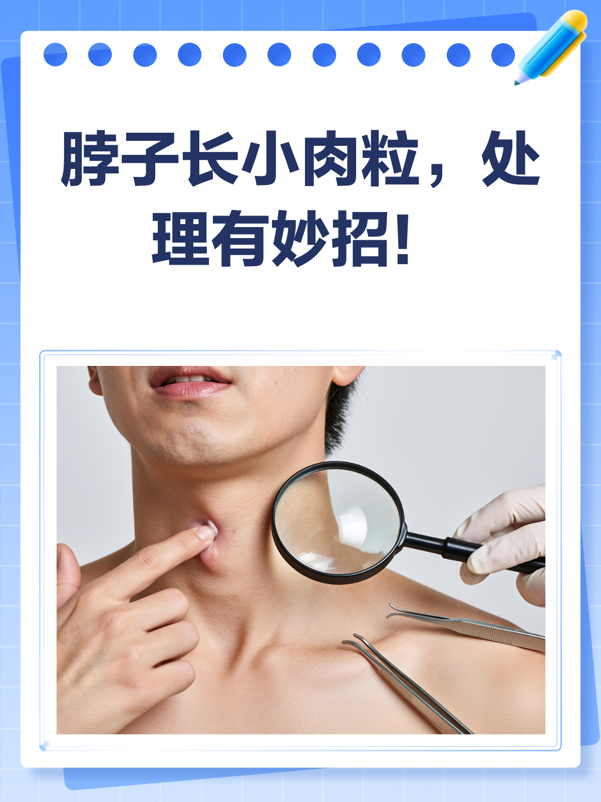 脖子长小肉粒?别急,处理有妙招!