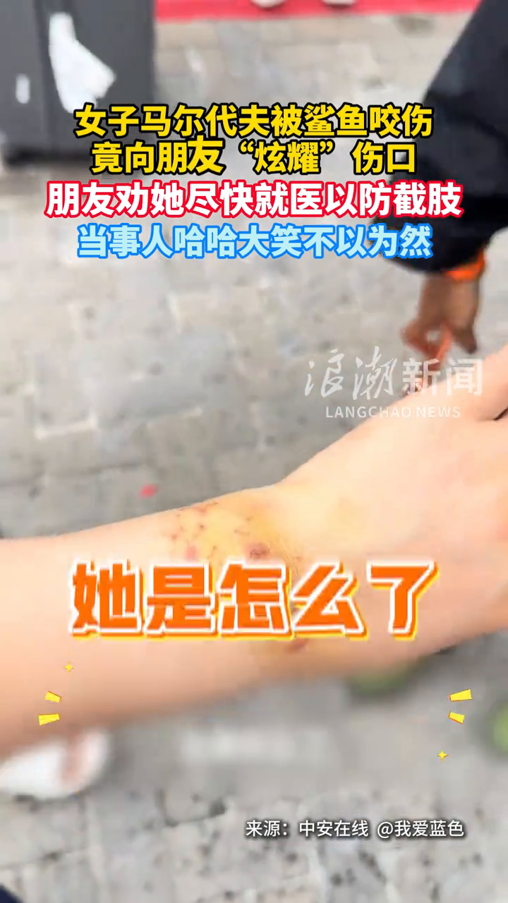 女子马尔代夫被鲨鱼咬伤 竟向朋友“炫耀”伤口