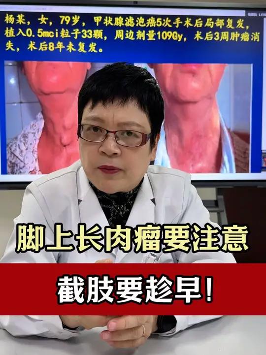 脚上长肉瘤是不是必须得截肢?