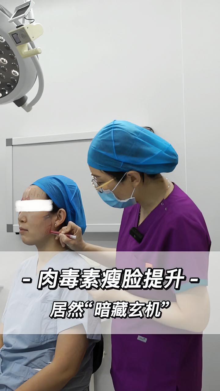 肉毒素瘦脸提升,居然“暗藏玄机” 医学科普 瘦脸 肉毒 肉毒毒素 小v脸 瘦咬肌 变美 涨