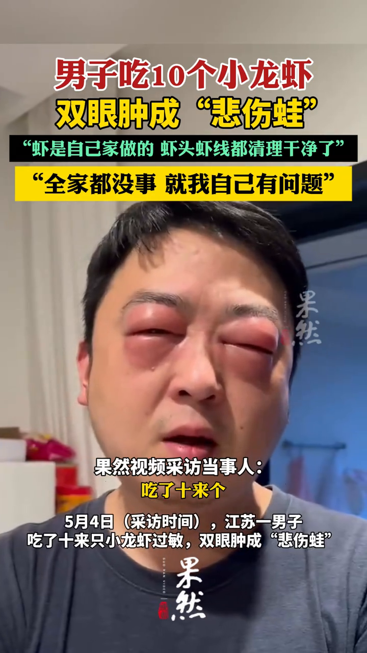 男子吃10个小龙虾,双眼肿成“悲伤蛙”