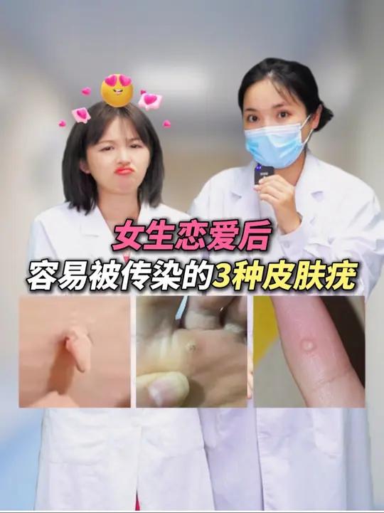 女生恋爱后，当心被传染三种皮肤疣，医生教你辨别处理