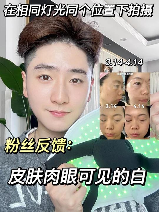 粉丝反馈:肉眼可见的白!相同位置光线下拍摄