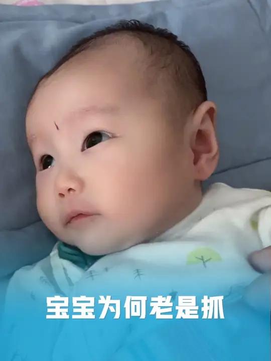 宝宝为何老是抓,这对自己也太狠了吧,抓那么严重