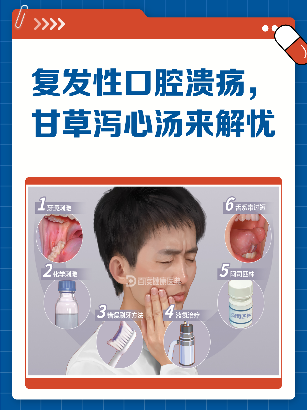复发性口腔溃疡？甘草泻心汤来帮忙！