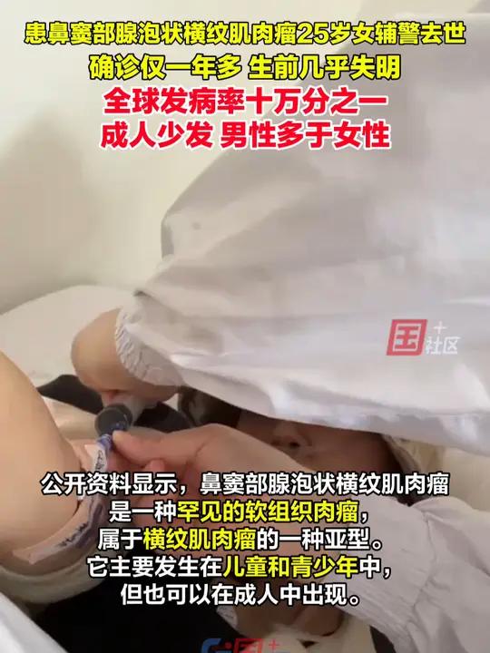 发病率仅为十万分之一,什么是鼻窦部腺泡状横纹肌肉瘤?12月6日,抗癌辅警卜娜娜因鼻窦部腺泡