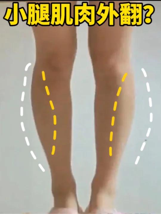 小腿肌肉外翻练它