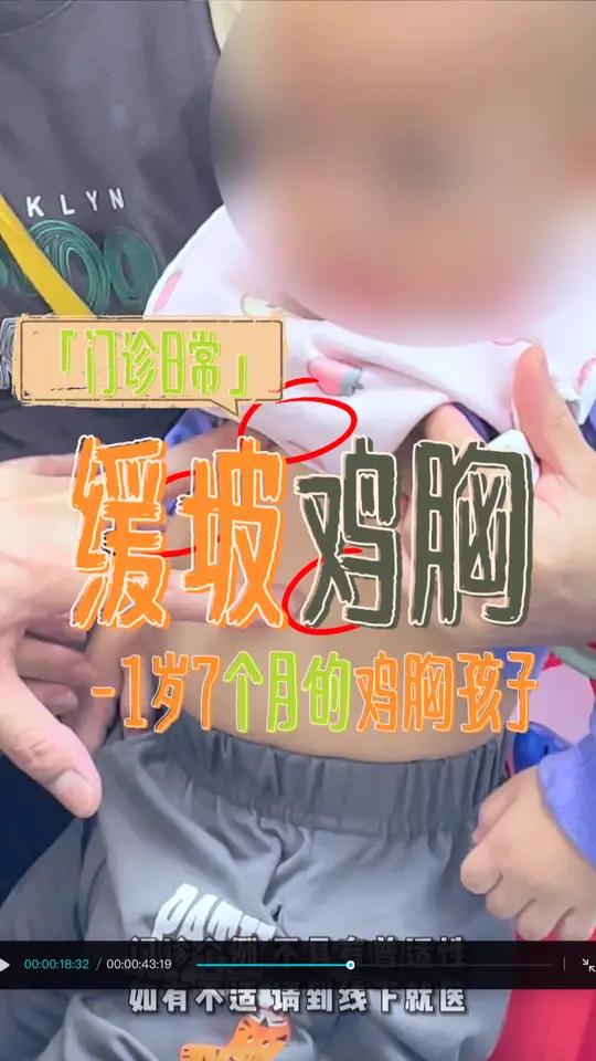 1岁7个月的缓坡型鸡胸的小宝宝,考虑到宝宝年纪小、凸出不明显的因素目前先采取保守治疗调整