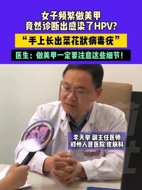 女子频繁做美甲竟然诊断出感染了HPV?“手上长出菜花状病毒疣”医生:做美甲一定要注意这些细