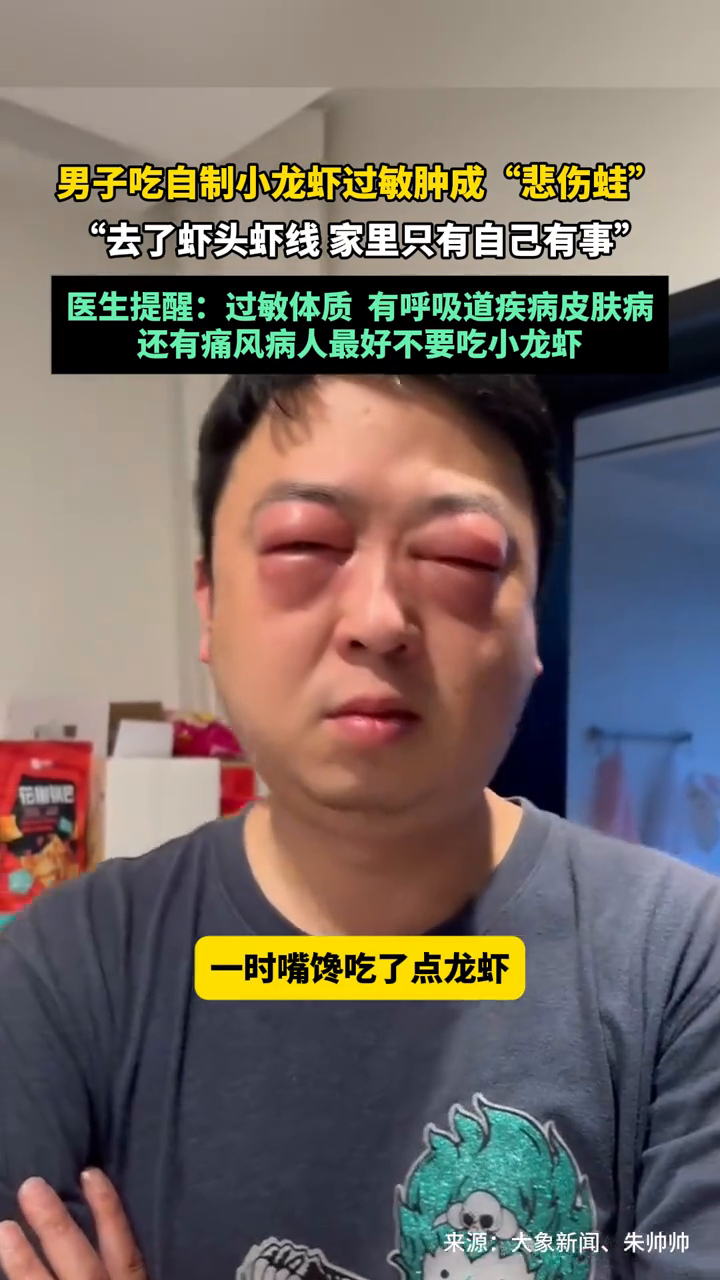 男子吃自制小龙虾过敏肿成“悲伤蛙”