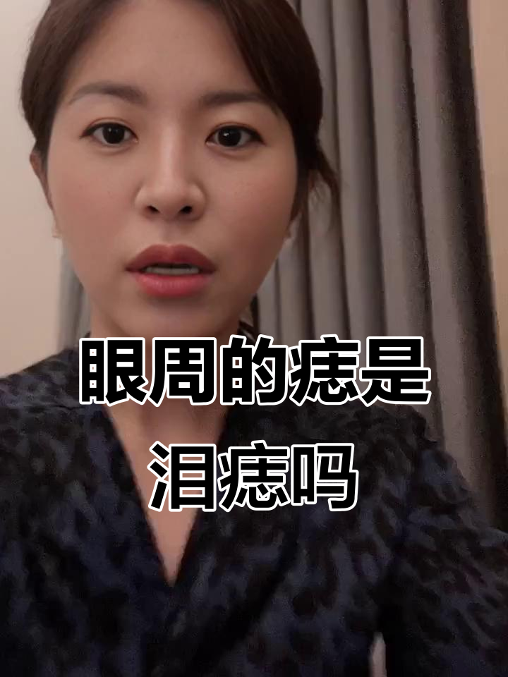 眼睛周围的痣真的是泪痣吗?它到底有什么含义