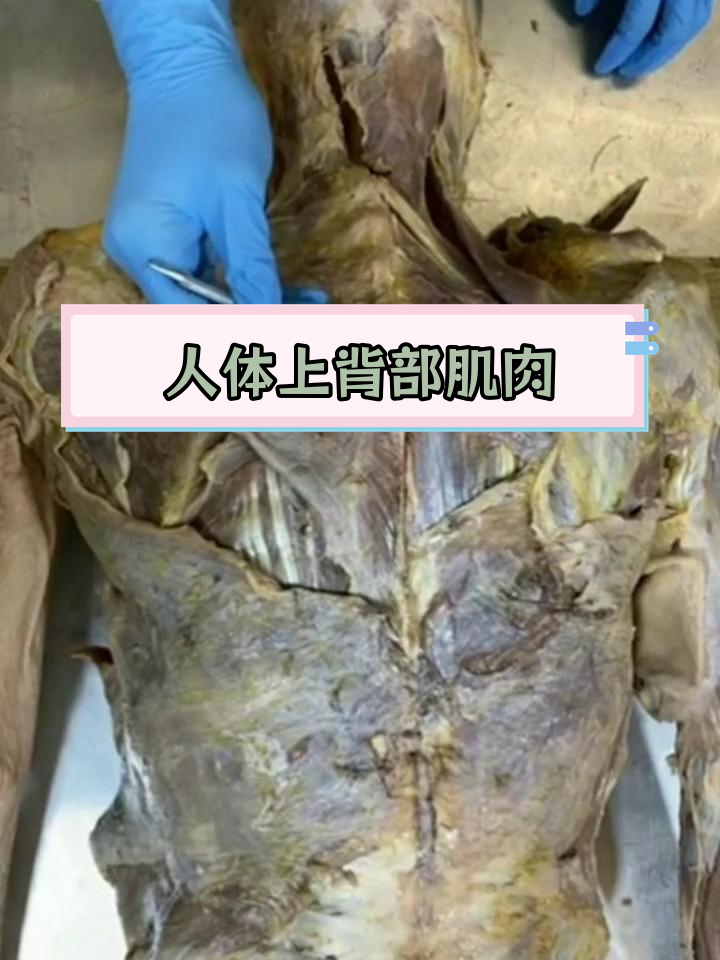 上背部骨骼肌结构解析:后锯肌与深层肌肉的关系