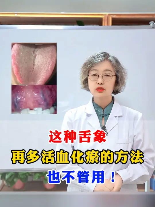 种舌象,用再多的活血化瘀的方法,血府逐瘀丸,桃红四物汤,也不管用!