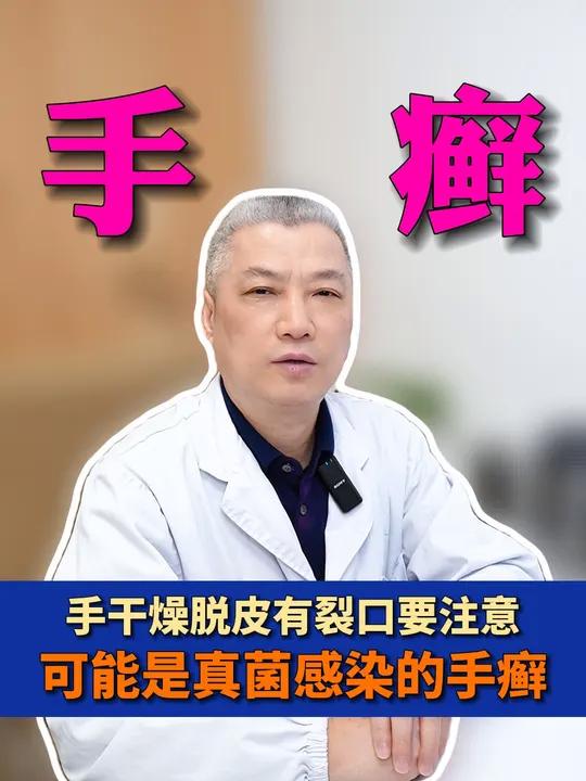 手部干燥脱皮有裂口，这是手癣，也叫鹅掌风！