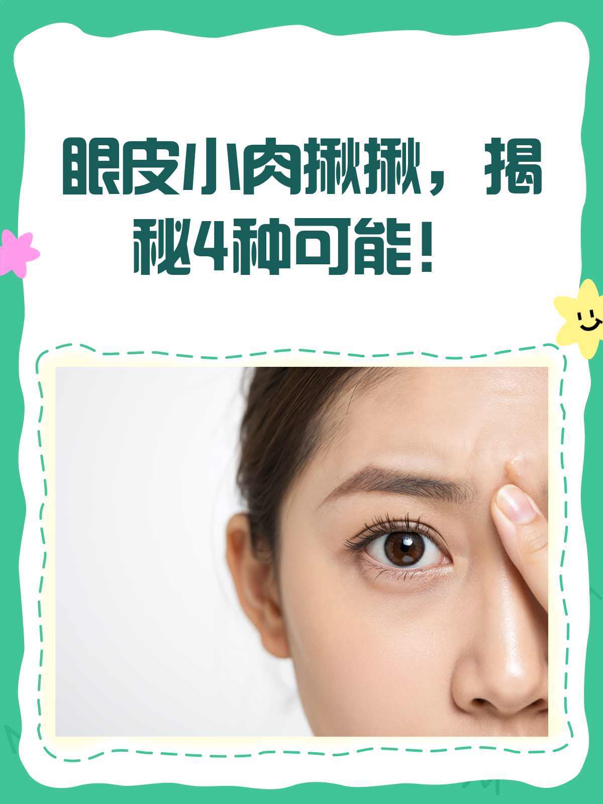 眼皮上的小肉揪揪，到底是啥来头？