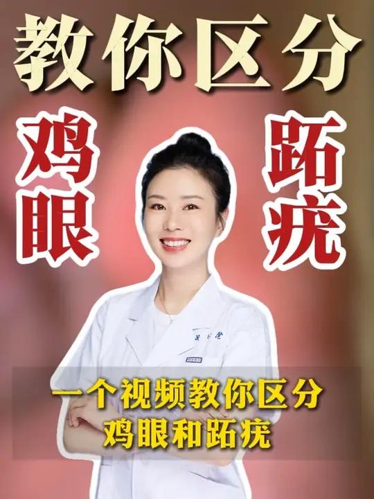 一个视频教你区分鸡眼和跖疣