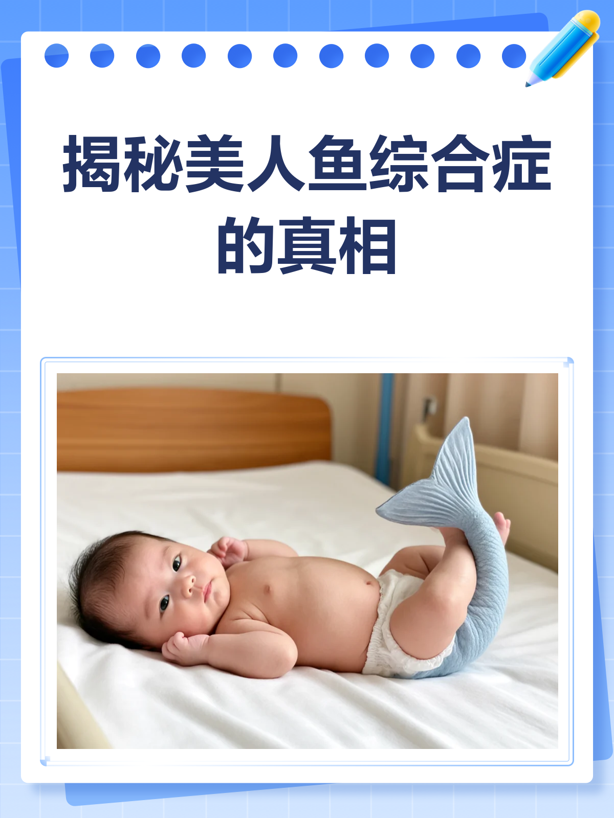 揭秘美人鱼综合症♀,你真的了解吗?