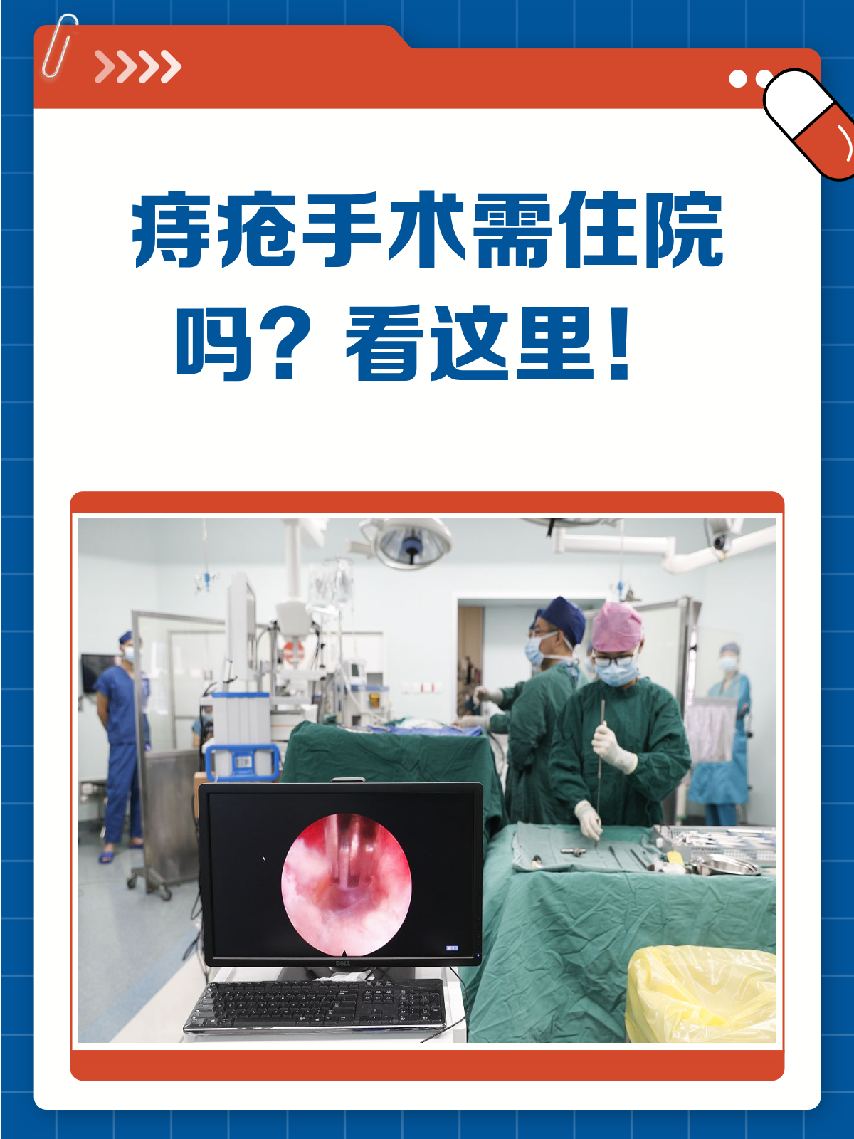 痔疮手术要不要住院?一文给你讲明白!
