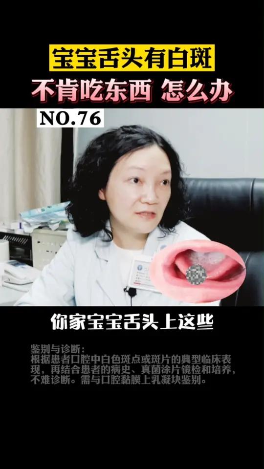 宝宝舌头上长了乳白色的斑片,擦不掉,别再以为是奶渍了!可能是鹅口疮!