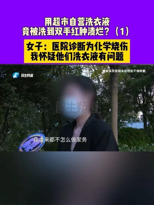 河南郑州:用超市自营洗衣液,竟被洗到双手红肿溃烂?女子:医院诊断为化学烧伤,我怀疑他们洗衣