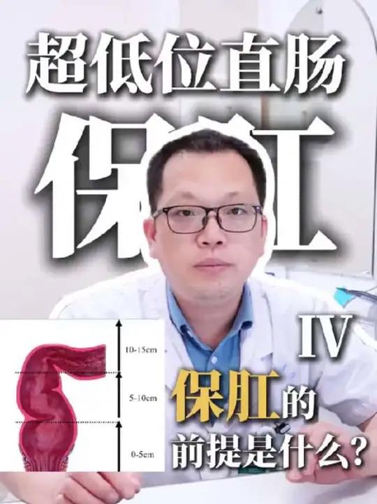 超低位直肠癌保肛,保肛的前提以及保肛需要的条件是什么呢?这是一位马上要进行手术的患者,刚好