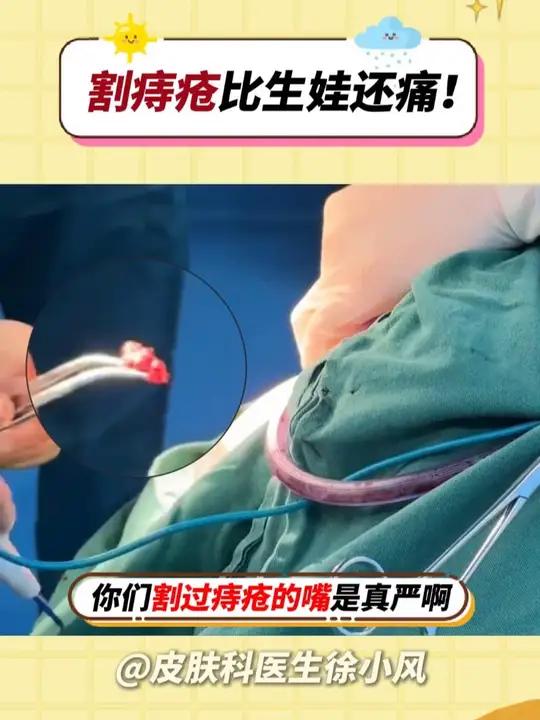 割痔疮的痛,希望你这辈子都感受不到!早期痔疮一定要及时处理!